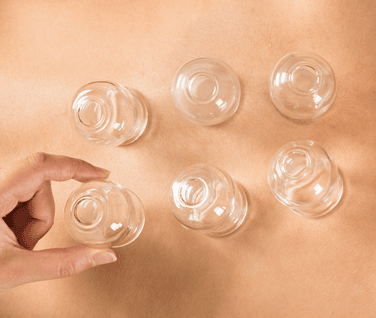 Dry Cupping