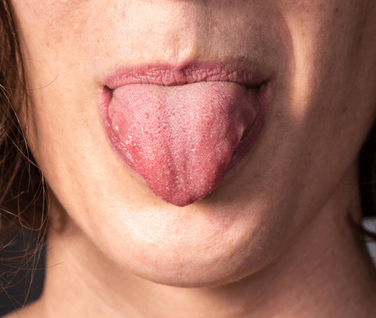 Step 3: Observation (望)